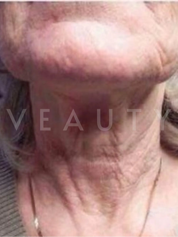Antes